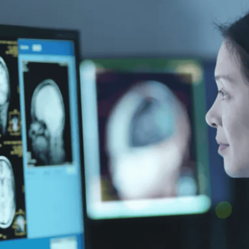 stock photo - student looking at computer with brain scan